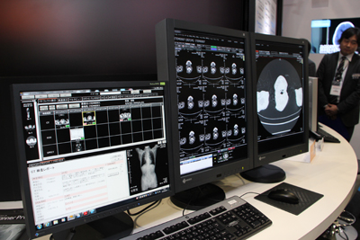 XTREK VIEWł́C摜̍\