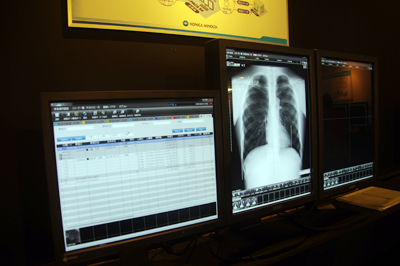 NEOVISTA I-PACS SX�ɓ��ڂ��ꂽ���E���ƂȂ鎩���S����Z�o�@�\