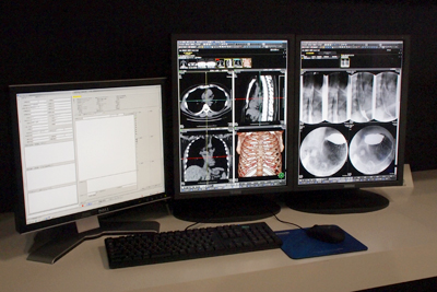 高い汎用性・拡張性・信頼性を実現した「Plissimo EX」