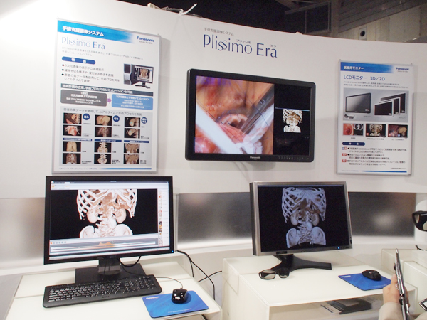 3D画像表示により安全な手術を支援する「Plissimo Era」