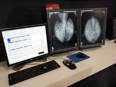 使い勝手の良いボタン操作で読影効率を上げる「Plissimo MG」