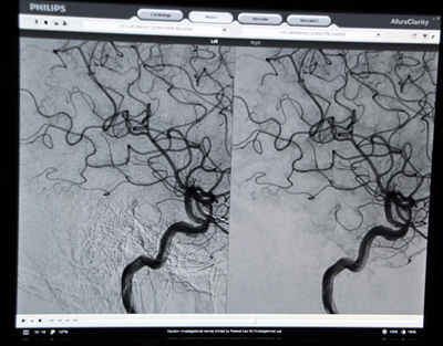 70ȏ̐ʂ팸ĎBeꂽAllura Claritỷ摜iEjC]̉摜