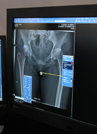 IDS7ŗpł鐮`OȂ̃CvgV~[Vc[Ortho Pkg