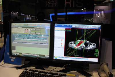 放射線治療計画のデータを専用端末を必要とせずに参照できる「RT Viewer」
