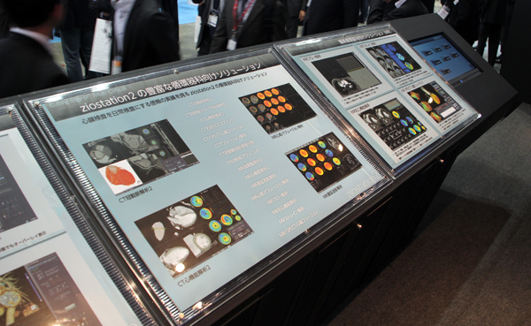 パネルでも多くのアプリケーションや臨床画像を展示