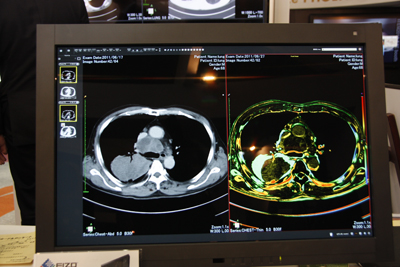 PHOENIX́C{^ЂƂŉߋ摜ĂяoCfʂō킹ĕ\BɁCdˍ킹āCǂ̒xωĂ邩J[\邱ƂłCo߂̔ceՂɂłB