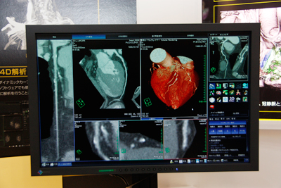 VE xコCXeg͂Ȃǂ̋@\ǉB