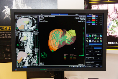 VȆ ubVAbvĐxグCRIȂǂ̋@\Ƃ̗Z\ƂȂǁC@\}ꂽB