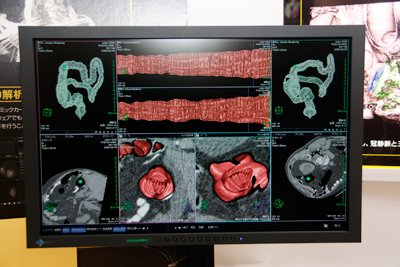 咰 WJ}ij́C咰̌äႢɕ\B