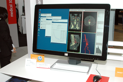 Coronis Fusion 4MP DL