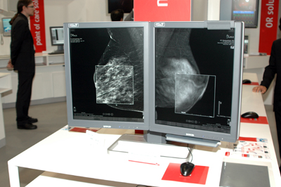 Mammo Tomosynthesis 5MP