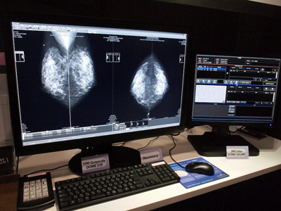 x[XDOME S10ƃNCfBJVXeYЂmammarỹf