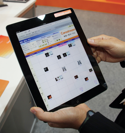 Vue PACSでは,放射線画像だけでなくさまざまな検査情報にアクセス可能なポータル機能を開発中