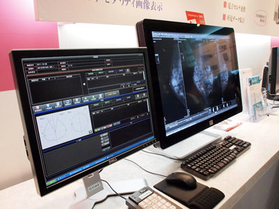 Coronis Fusion 10MPłmammarỹf