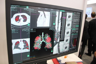 3D摜̓VXeSYNAPSE VINCENTł͋Cǎx͂ȂǐV@\𑽐Љ