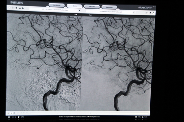 ]ijAllura ClarityiEjɂ铪ǉ摜̔r