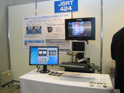 ��JSRT424������3D�f�B�X�v���C�ɂ�����͋[���ǂ̗��̎��F���Ɋւ��錟��