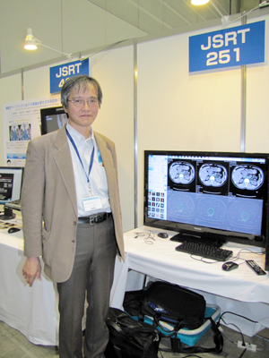 <JSRT251>CT画像におけるTotal Variation(TV)法の基礎検討