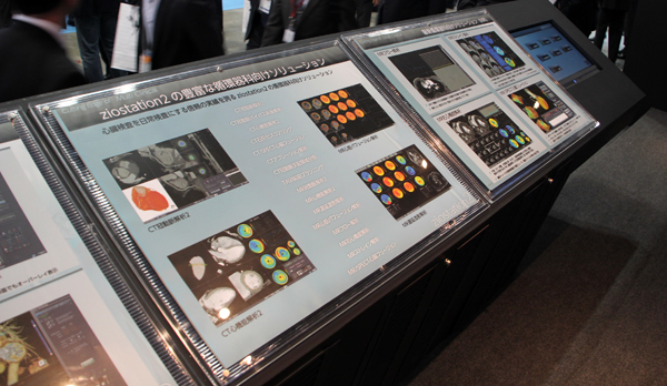 パネルやタッチパネル液晶モニタなどで診療科ごとにziostation2のマルチフュージョンのアプリケーションを解説