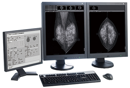 乳腺画像診断ワークステーション「AMULET BI-D」