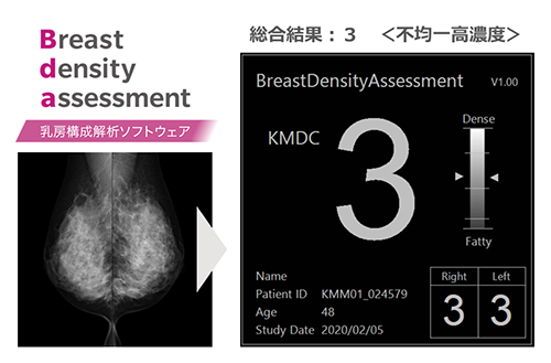 乳房構成解析ソフトウェアBreast Density Assessment（Bda）