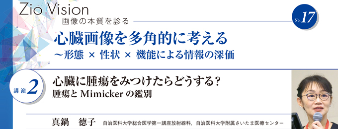 Zio Vision 画像の本質を診る(ザイオソフト)