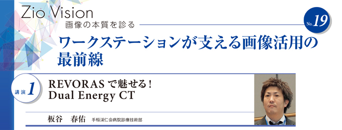 REVORAS で魅せる! Dual Energy CT
