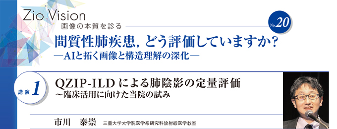 QZIP-ILDによる肺陰影の定量評価 ～臨床活用に向けた当院の試み