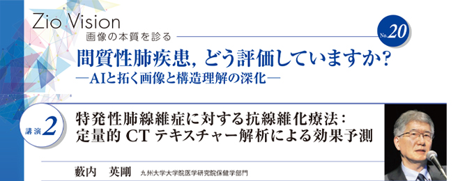 特発性肺線維症に対する抗線維化療法：定量的CTテキスチャー解析による効果予測