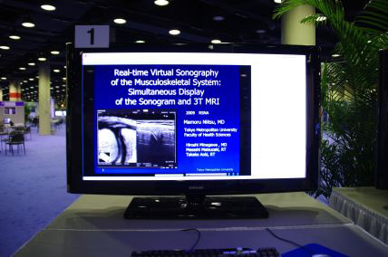 gReal-time Virtual Sonography of the Musculoskeletal System: Simultaneous Display of the Sonogram and 3 T MRIhiLL-MK2447j