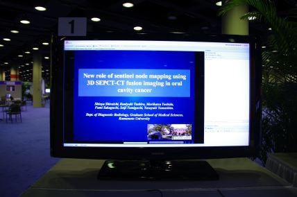 gNew Role of Sentinel Node Mapping Using 3D SEPCT-CT Fusion Imaging in Oral Cavity Cancerhi LL-NM2310j