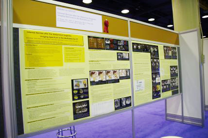 gInternal Hernias after the Abdominal Surgeries: Imaging Spectrum in the Multidetector CThiLL-GI3720j