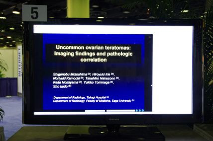 gUncommon Ovarian Teratomas: Imaging Findings and Pathologic CorrelationhiLL-OB4765j