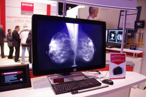 u[X̑SʂɓWꂽCoronis Fusion 10MP