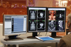 CARESTREAM PACS o[W11