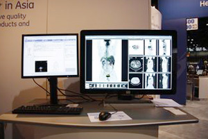 Centricity IWiPET/CTj