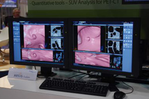 Band-view\xelis Colon