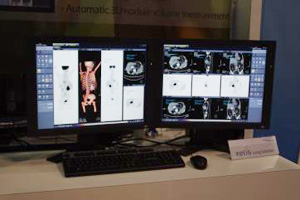 xelis FusionPETCT̃t[W摜