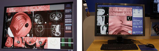 eRЁiEjCUCI\tgЁij̃[NXe[VɓڂꂽuColonCADv