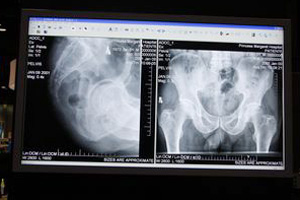 47C`RadiForce LX470W