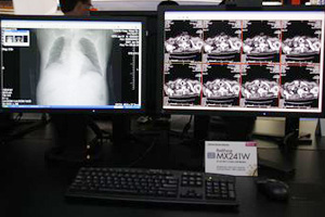 22^RadiForce MX220Wij24^RadiForce MX241WiEj