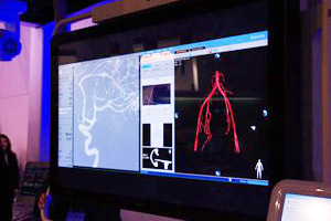 Allura Xper FD2056C`LCDj^