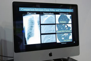 gVZVXł̔x񌟐f̃v[e[V