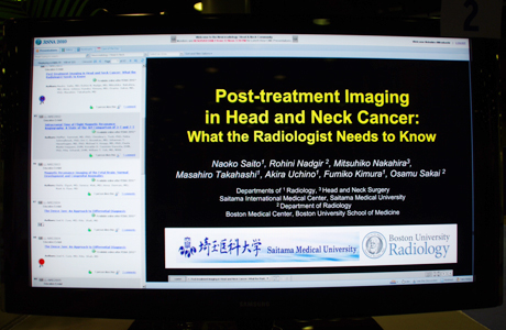 LL-NRE2801 Post-treatment Imaging in Head and Neck Cancer: What the Radiologist Needs to Know Naoko Saito M.D.