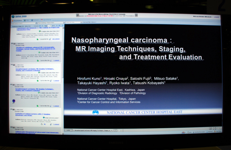 LL-NRE2904 Nasopharyngeal Carcinoma: MR Imaging Techniques, Staging, and Treatment Evaluation Hirofumi Kuno M.D.