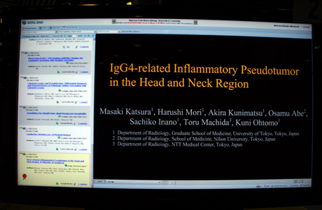 LL-NRE2897 IgG4-related Inflammatory Pseudotumor in the Head and Neck Region: A Mimicker of Neoplasm Masaki Katsura M.D.