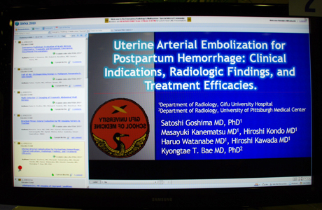 LL-ERE2233 Uterine Arterial Embolization for Postpartum Hemorrhage: Clinical Indications, Radiologic Findings, and Treatment Efficacies Satoshi Goshima M.D. PH.D.