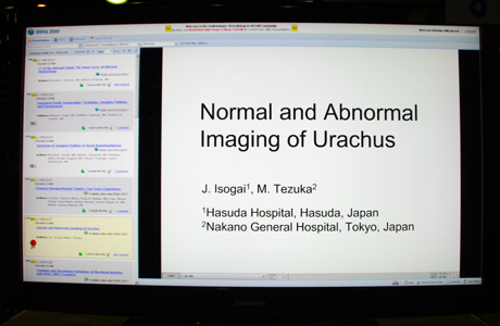LL-URE4127 Normal and Abnormal Imaging of Urachus Jun Isogai