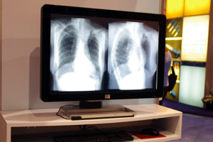 mNj^̐ViłCoronis Fusion 10MP