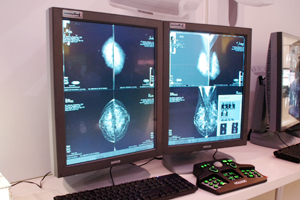 }OtBpCoronis 5MP Mammo